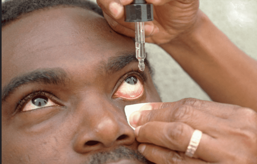 Eye Care Product Recall